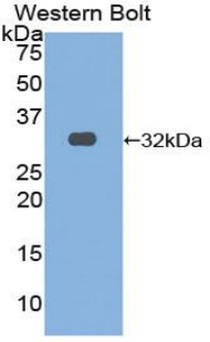 Polyclonal Antibody to Oncostatin M Receptor (OSMR)