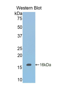 Polyclonal Antibody to Inhibin Beta B (INHbB)