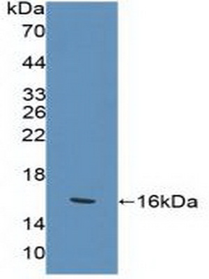 Polyclonal Antibody to Killer Cell Lectin Like Receptor Subfamily K, Member 1 (KLRK1)