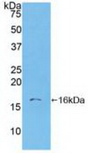 Polyclonal Antibody to S100 Calcium Binding Protein A6 (S100A6)