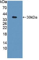 Polyclonal Antibody to Guanylate Binding Protein 4 (GBP4)