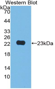 Polyclonal Antibody to Junctional Adhesion Molecule 2 (JAM2)