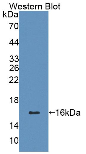 Polyclonal Antibody to Cluster Of Differentiation 7 (CD7)