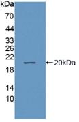 Polyclonal Antibody to Neprilysin (CD10)