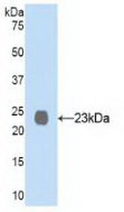 Polyclonal Antibody to Neprilysin (CD10)