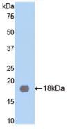 Polyclonal Antibody to Neprilysin (CD10)