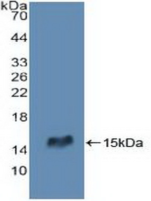 Polyclonal Antibody to Receptor Interacting Serine Threonine Kinase 2 (RIPK2)