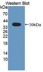 Polyclonal Antibody to Receptor Interacting Serine Threonine Kinase 2 (RIPK2)