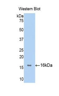 Polyclonal Antibody to Fibroblast Growth Factor Receptor 1 (FGFR1)