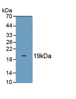 Polyclonal Antibody to S100 Calcium Binding Protein A8 (S100A8)