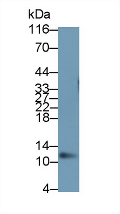 Polyclonal Antibody to S100 Calcium Binding Protein A8 (S100A8)