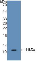 Polyclonal Antibody to S100 Calcium Binding Protein A8 (S100A8)