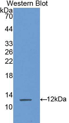 Polyclonal Antibody to S100 Calcium Binding Protein A8 (S100A8)