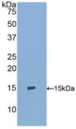 Polyclonal Antibody to S100 Calcium Binding Protein A9 (S100A9)