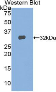 Polyclonal Antibody to Signal Transducer And Activator Of Transcription 2 (STAT2)