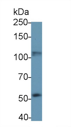 Polyclonal Antibody to Signal Transducer And Activator Of Transcription 2 (STAT2)