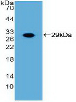 PAB797Hu01.jpg