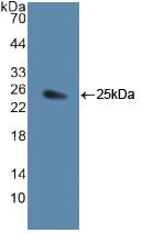 Polyclonal Antibody to Jagged 1 (JAG1)