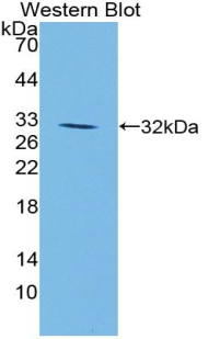 Polyclonal Antibody to Jagged 1 (JAG1)