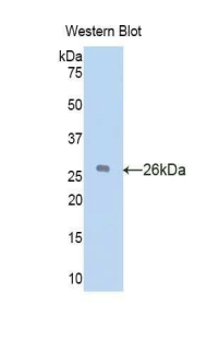 Polyclonal Antibody to Vitamin D Binding Protein (DBP)