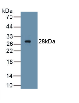 Polyclonal Antibody to Frizzled Homolog 4 (FZD4)