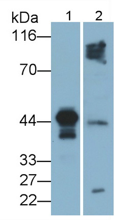 Polyclonal Antibody to Squamous Cell Carcinoma Antigen 1/2 (SCCA1/SCCA2)