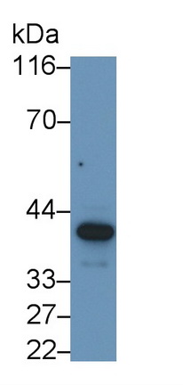 Polyclonal Antibody to Squamous Cell Carcinoma Antigen 1/2 (SCCA1/SCCA2)