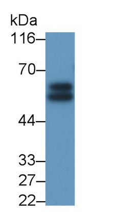 Polyclonal Antibody to Interleukin 6 Receptor (IL6R)