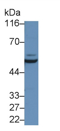 Polyclonal Antibody to Interleukin 6 Receptor (IL6R)