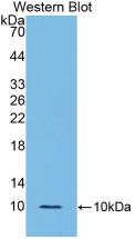 Polyclonal Antibody to Interleukin 6 Receptor (IL6R)