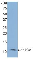 Polyclonal Antibody to Interleukin 6 Receptor (IL6R)