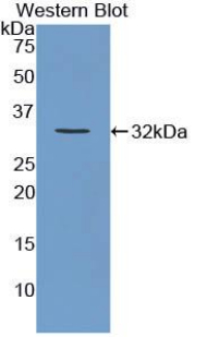 Polyclonal Antibody to Versican (VCAN)