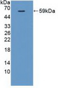 Polyclonal Antibody to Vascular Endothelial Growth Factor Receptor 1 (VEGFR1)