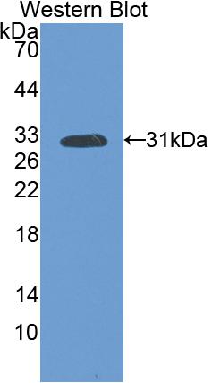 Polyclonal Antibody to Vascular Endothelial Growth Factor Receptor 1 (VEGFR1)