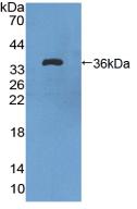 Polyclonal Antibody to Vascular Endothelial Growth Factor Receptor 1 (VEGFR1)