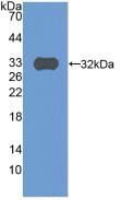 Polyclonal Antibody to Complement Component 9 (C9)