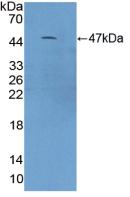 Polyclonal Antibody to Complement Component 9 (C9)