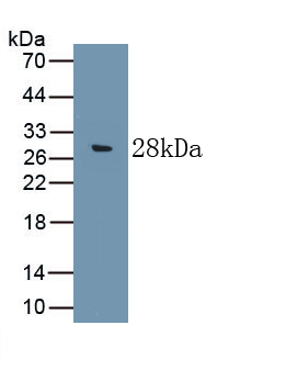 Polyclonal Antibody to Complement Component 9 (C9)