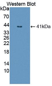 Polyclonal Antibody to Nuclear Factor Kappa B (NFkB)