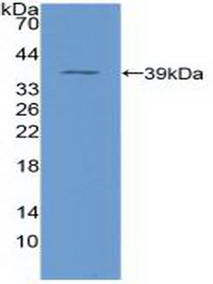 Polyclonal Antibody to Nuclear Factor Kappa B (NFkB)