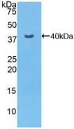 Polyclonal Antibody to Nuclear Factor Kappa B (NFkB)