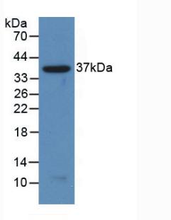 Polyclonal Antibody to Nuclear Factor Kappa B2 (NFkB2)