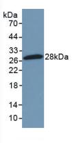 Polyclonal Antibody to Nuclear Factor Kappa B2 (NFkB2)