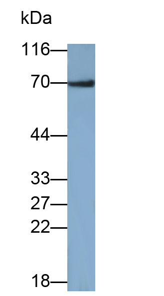 Polyclonal Antibody to Hedgehog Homolog, Sonic (SHH)