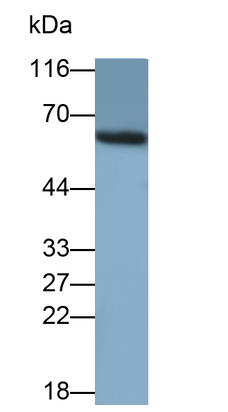 Polyclonal Antibody to Hedgehog Homolog, Sonic (SHH)