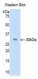 Polyclonal Antibody to Complement Factor D (CFD)