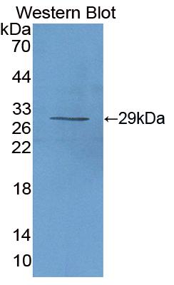 Polyclonal Antibody to Interleukin 2 Receptor Alpha (IL2Ra)