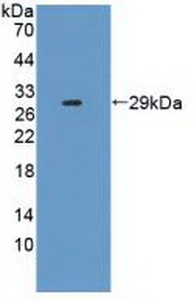 Polyclonal Antibody to Interleukin 2 Receptor Alpha (IL2Ra)