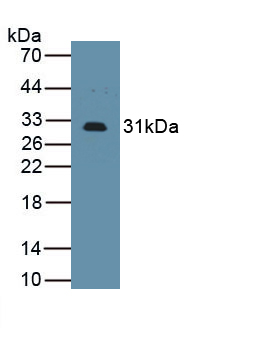 Polyclonal Antibody to Interleukin 2 Receptor Alpha (IL2Ra)