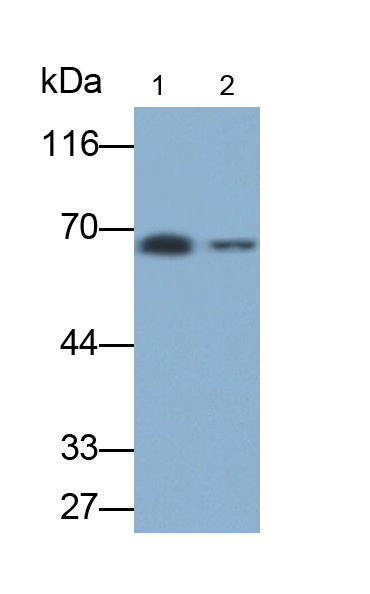 Polyclonal Antibody to Cholinergic Receptor, Muscarinic 3 (CHRM3)